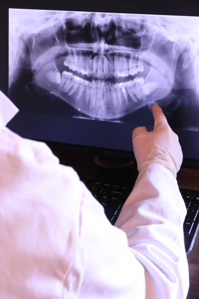 Best Emergency Root Canal Therapy in Hollis, OK