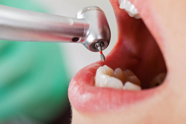 Best Emergency Denture Repair in Hollis, OK